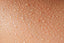 sweat triggers